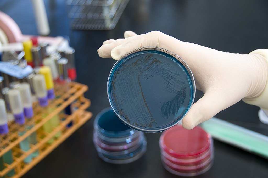 Detección de Salmonella en medios de cultivo